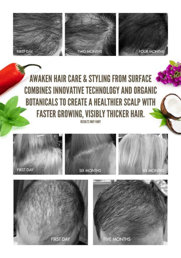SURFACE AWAKEN SCALP ELIXIR - Buy Wigs USA